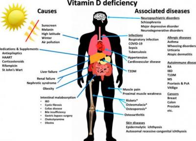 کمبود ویتامین D چه علائم و عوارضی دارد و چطور باید درمان گردد؟